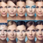The Impact of Plastic Surgery on Self-Perception and Society
