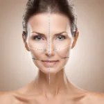 The Rise of the One Stitch Facelift: A Scarless Solution to Facial Rejuvenation