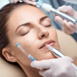 Achieving A Smoother Skin Texture With Microneedling