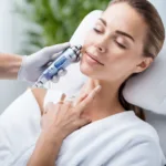 Best Microneedling Devices For Home Use