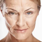Does Facial Rejuvenation Reduce Wrinkles