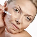 How Much Does Natural Wrinkle Reduction Cost?