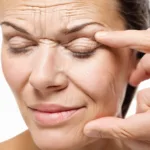 How to Get Rid of Forehead Wrinkles Overnight Naturally