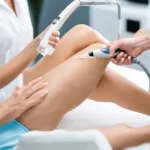 Long-Term Results And Maintenance After Laser Hair Removal