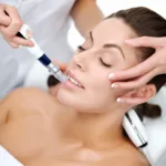 Can Microdermabrasion Reduce Pore Size?