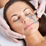 Can Microdermabrasion Remove Scars?