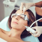 Choosing The Right Laser Hair Removal Provider