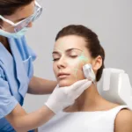 Laser Treatments for Acne Scars: Which Laser is Right for You?