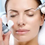 Microdermabrasion for Large Pores