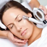 Microdermabrasion for Stretch Marks