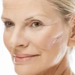 Natural Alternatives to Botox for Wrinkle Reduction
